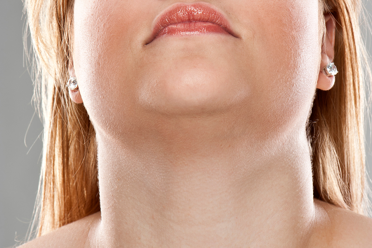 8 egyszerű gyakorlat, ami eltünteti a hájat az arcodról | Femcafe